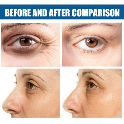 EELHOE Collagen Eye Mask