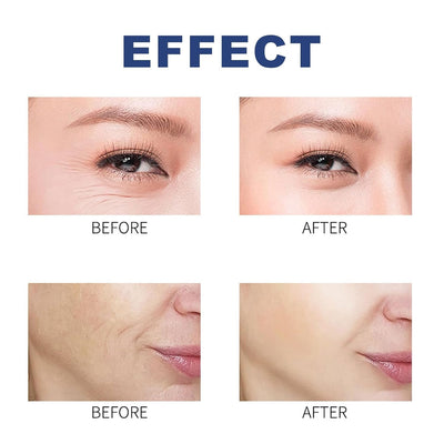 Collagen Face Mask (5 Pack)