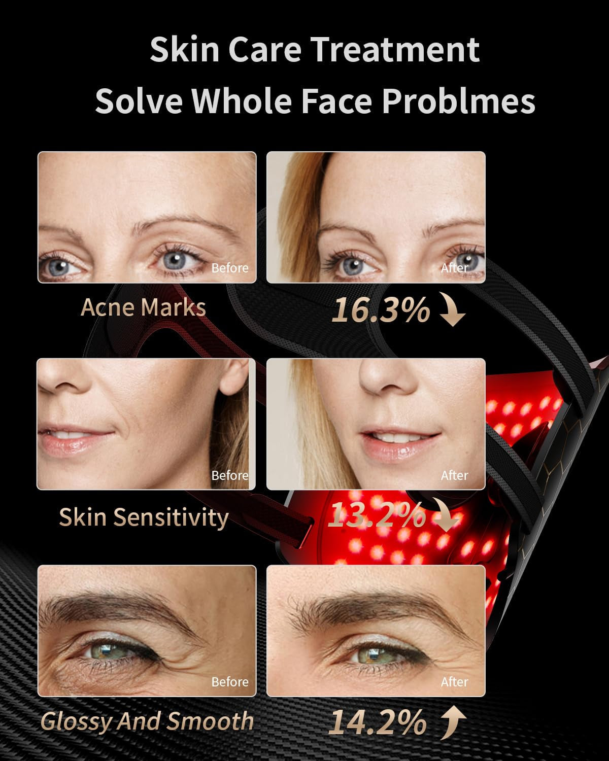 7-Color LED Facial Mask