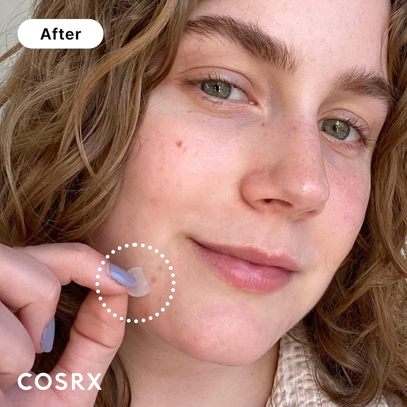 Cosrx Acne Pimple Patch (96 Patches